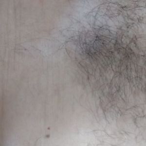 tonci